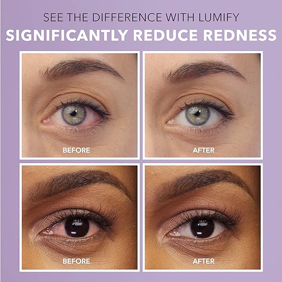 Lumify Redness Reliever Eye Drops - .25 Oz / 7. 5 Ml